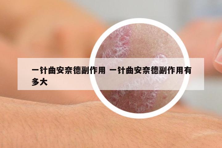 一針曲安奈德副作用 一針曲安奈德副作用有多大