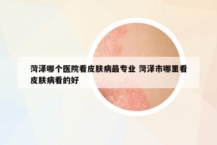 菏澤哪個(gè)醫(yī)院看皮膚病最專業(yè) 菏澤市哪里看皮膚病看的好