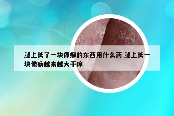 腿上長了一塊像癬的東西用什么藥 腿上長一塊像癬越來越大干癢