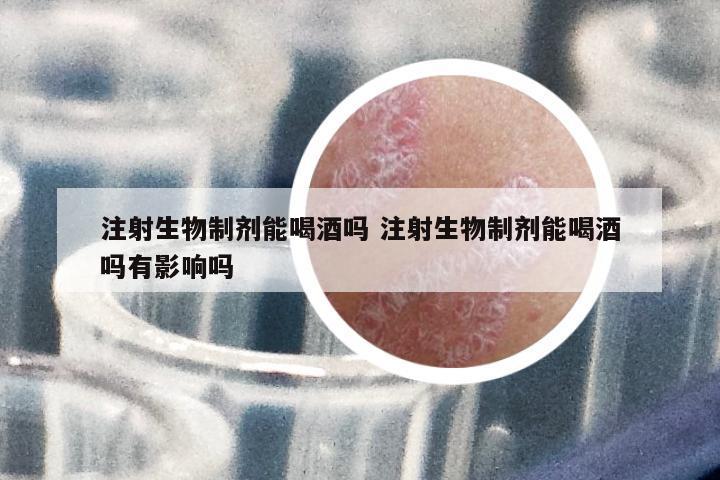 注射生物制劑能喝酒嗎 注射生物制劑能喝酒嗎有影響嗎