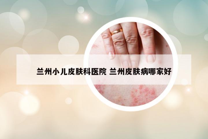 蘭州小兒皮膚科醫(yī)院 蘭州皮膚病哪家好