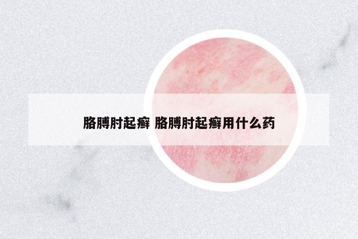 胳膊肘起癬 胳膊肘起癬用什么藥