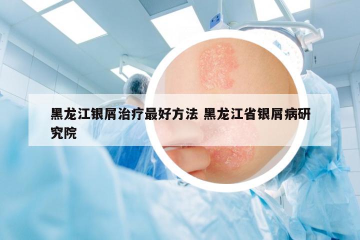 黑龍江銀屑治療最好方法 黑龍江省銀屑病研究院