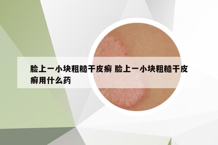 臉上一小塊粗糙干皮癬 臉上一小塊粗糙干皮癬用什么藥