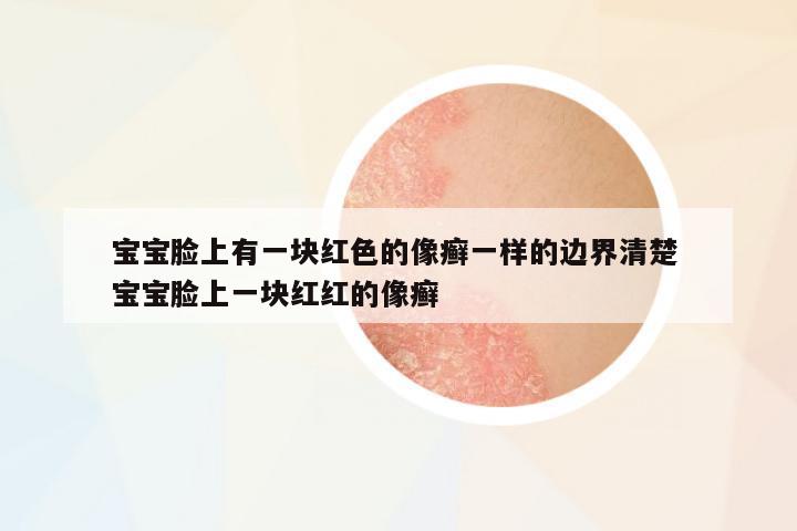寶寶臉上有一塊紅色的像癬一樣的邊界清楚 寶寶臉上一塊紅紅的像癬