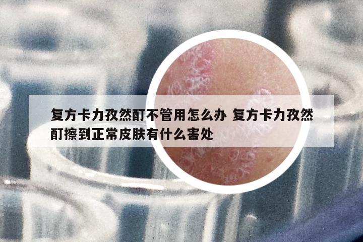 復(fù)方卡力孜然酊不管用怎么辦 復(fù)方卡力孜然酊擦到正常皮膚有什么害處