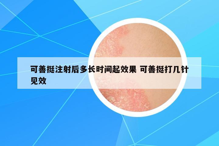 可善挺注射后多長時間起效果 可善挺打幾針見效