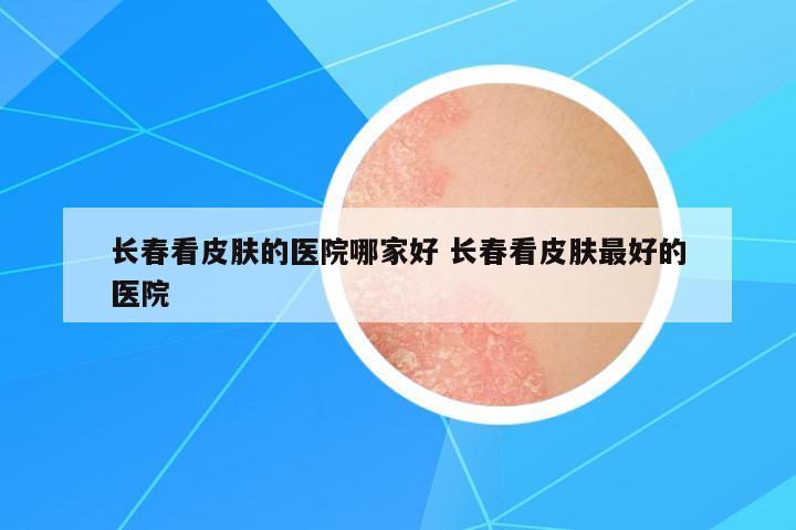 長春看皮膚的醫(yī)院哪家好 長春看皮膚最好的醫(yī)院