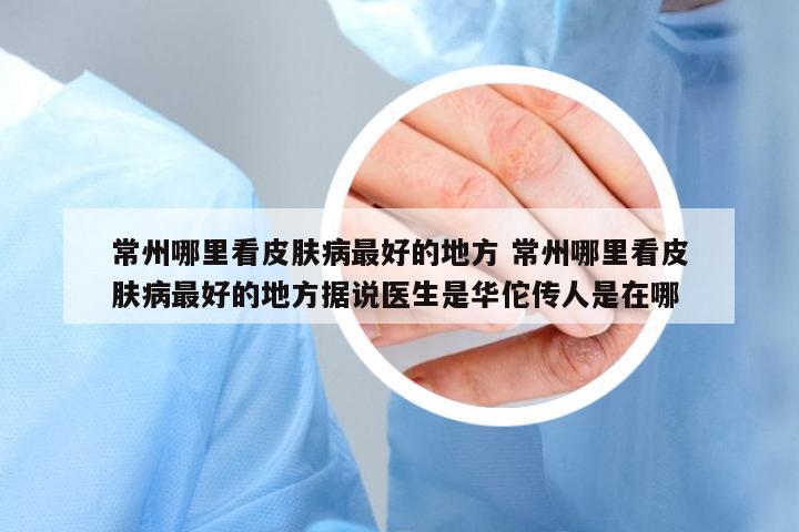 常州哪里看皮膚病最好的地方 常州哪里看皮膚病最好的地方據(jù)說醫(yī)生是華佗傳人是在哪