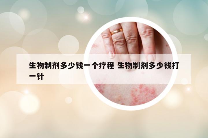 生物制劑多少錢一個(gè)療程 生物制劑多少錢打一針