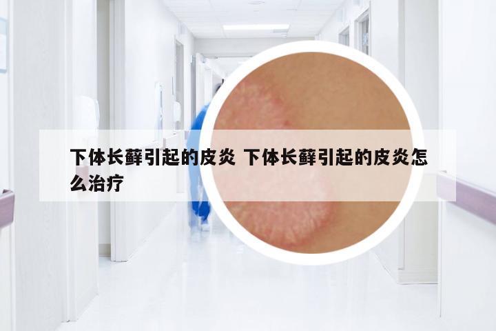 下體長蘚引起的皮炎 下體長蘚引起的皮炎怎么治療