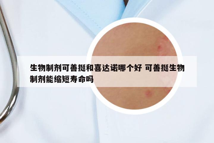 生物制劑可善挺和喜達(dá)諾哪個好 可善挺生物制劑能縮短壽命嗎