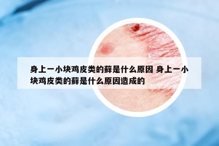 身上一小塊雞皮類的蘚是什么原因 身上一小塊雞皮類的蘚是什么原因造成的