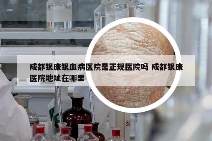 成都銀康銀血病醫(yī)院是正規(guī)醫(yī)院?jiǎn)?成都銀康醫(yī)院地址在哪里