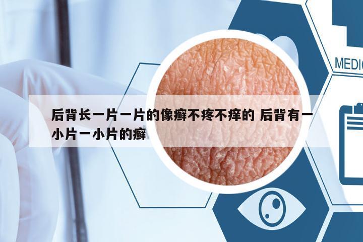 后背長一片一片的像癬不疼不癢的 后背有一小片一小片的癬