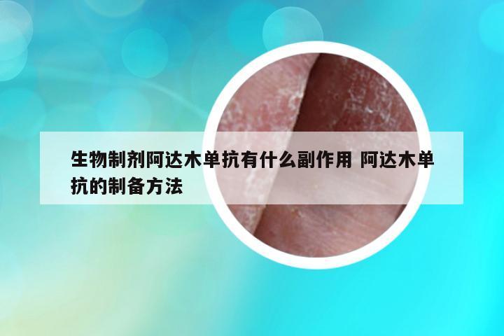 生物制劑阿達(dá)木單抗有什么副作用 阿達(dá)木單抗的制備方法