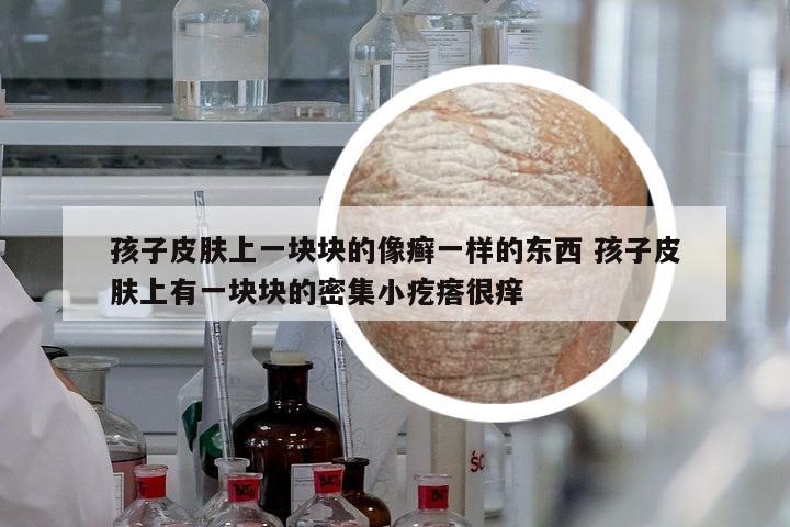 孩子皮膚上一塊塊的像癬一樣的東西 孩子皮膚上有一塊塊的密集小疙瘩很癢