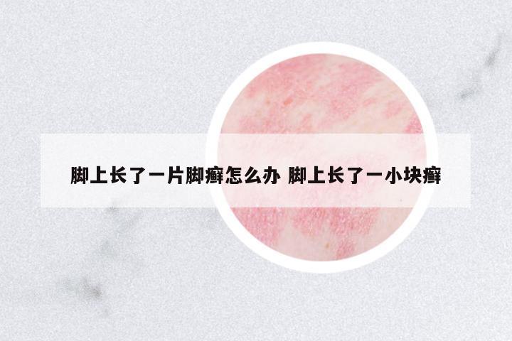腳上長(zhǎng)了一片腳癬怎么辦 腳上長(zhǎng)了一小塊癬