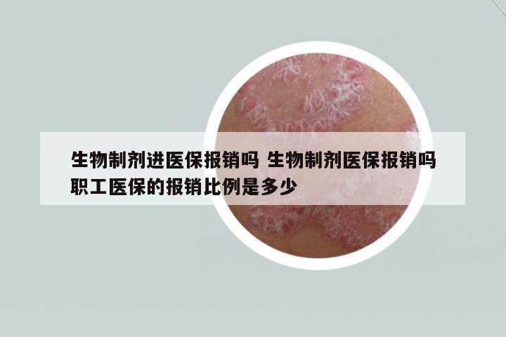 生物制劑進(jìn)醫(yī)保報銷嗎 生物制劑醫(yī)保報銷嗎職工醫(yī)保的報銷比例是多少
