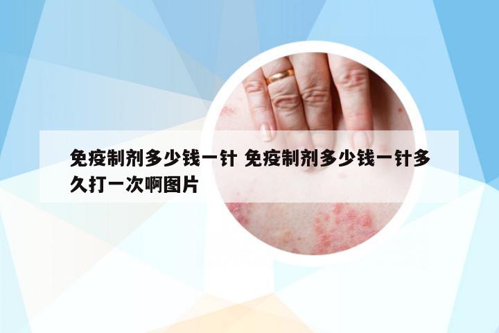 免疫制劑多少錢一針 免疫制劑多少錢一針多久打一次啊圖片