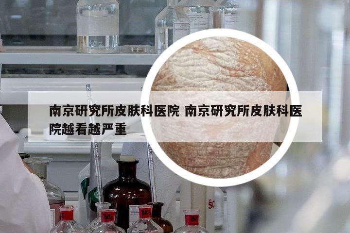 南京研究所皮膚科醫(yī)院 南京研究所皮膚科醫(yī)院越看越嚴(yán)重