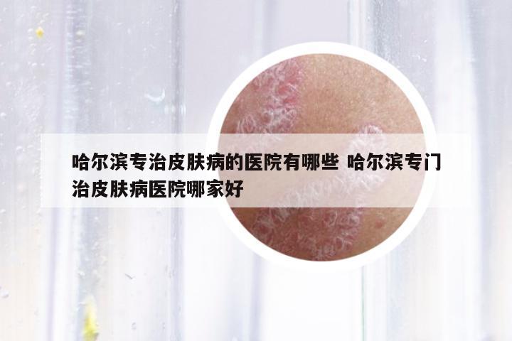 哈爾濱專(zhuān)治皮膚病的醫(yī)院有哪些 哈爾濱專(zhuān)門(mén)治皮膚病醫(yī)院哪家好