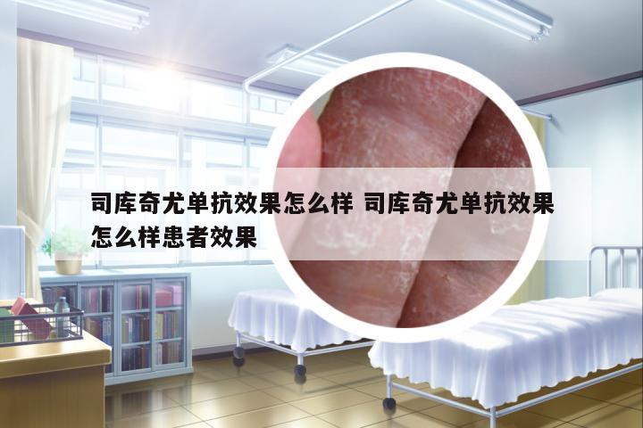 司庫奇尤單抗效果怎么樣 司庫奇尤單抗效果怎么樣患者效果