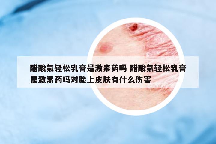 醋酸氟輕松乳膏是激素藥嗎 醋酸氟輕松乳膏是激素藥嗎對臉上皮膚有什么傷害