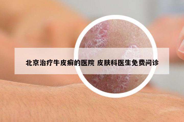 北京治療牛皮癬的醫(yī)院 皮膚科醫(yī)生免費問診