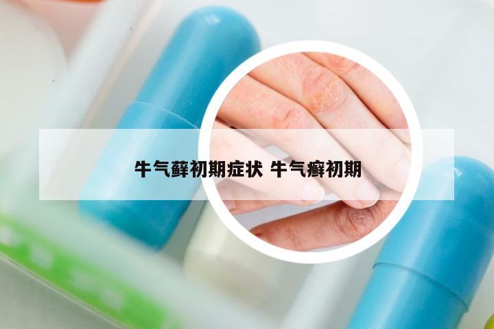 牛氣蘚初期癥狀 牛氣癬初期