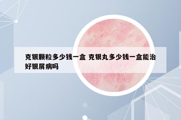 克銀顆粒多少錢一盒 克銀丸多少錢一盒能治好銀屑病嗎
