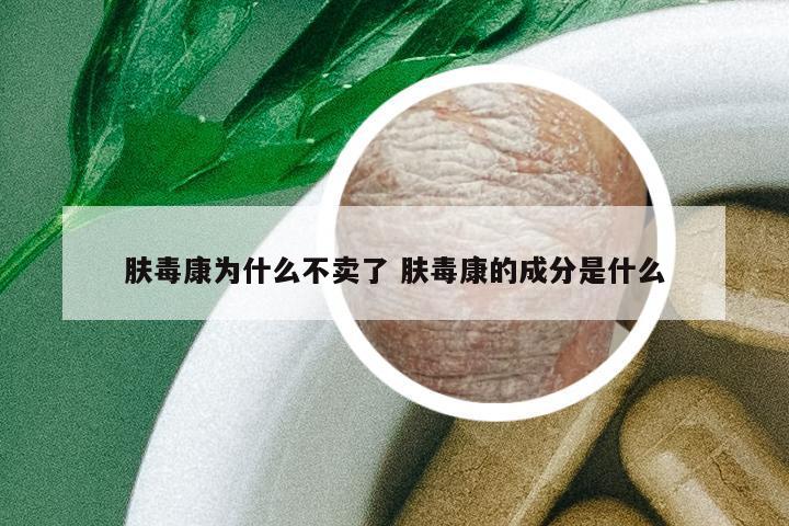 膚毒康為什么不賣了 膚毒康的成分是什么