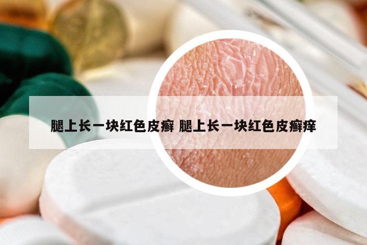 腿上長一塊紅色皮癬 腿上長一塊紅色皮癬癢