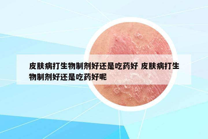 皮膚病打生物制劑好還是吃藥好 皮膚病打生物制劑好還是吃藥好呢
