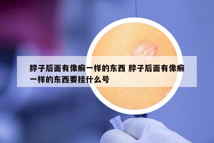 脖子后面有像癬一樣的東西 脖子后面有像癬一樣的東西要掛什么號(hào)