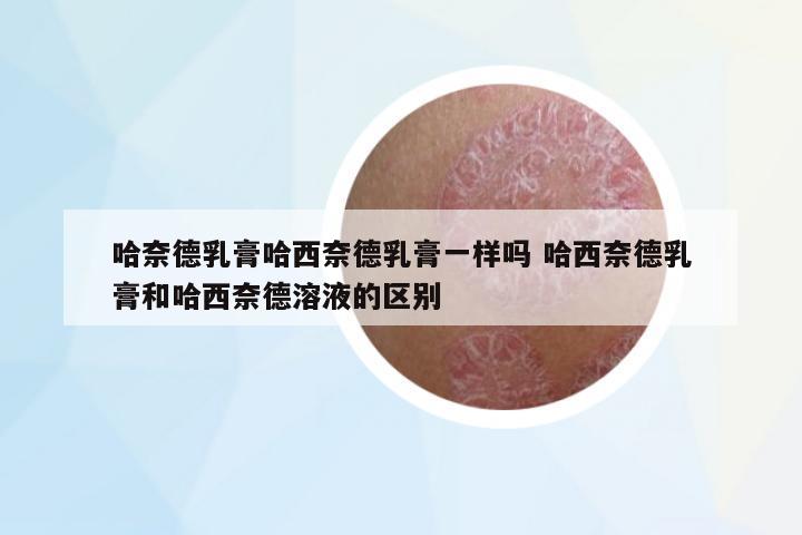 哈奈德乳膏哈西奈德乳膏一樣嗎 哈西奈德乳膏和哈西奈德溶液的區(qū)別