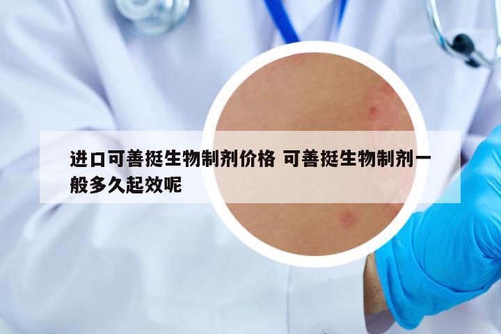 進(jìn)口可善挺生物制劑價(jià)格 可善挺生物制劑一般多久起效呢