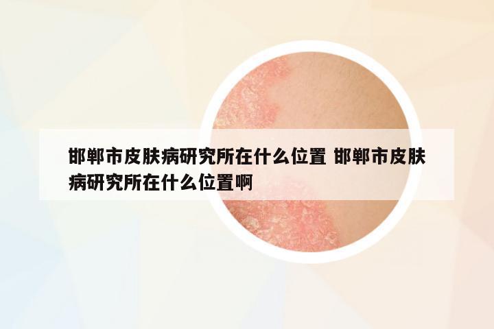邯鄲市皮膚病研究所在什么位置 邯鄲市皮膚病研究所在什么位置啊