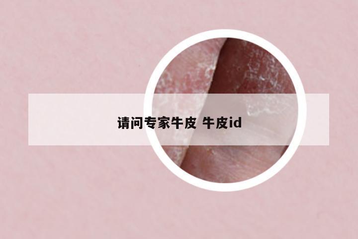 請問專家牛皮 牛皮id