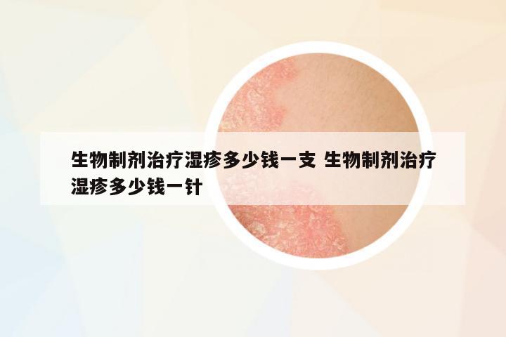 生物制劑治療濕疹多少錢一支 生物制劑治療濕疹多少錢一針