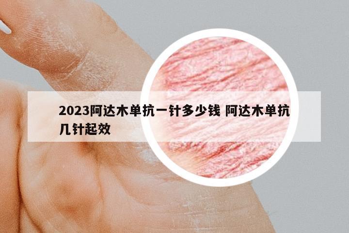 2023阿達(dá)木單抗一針多少錢 阿達(dá)木單抗幾針起效