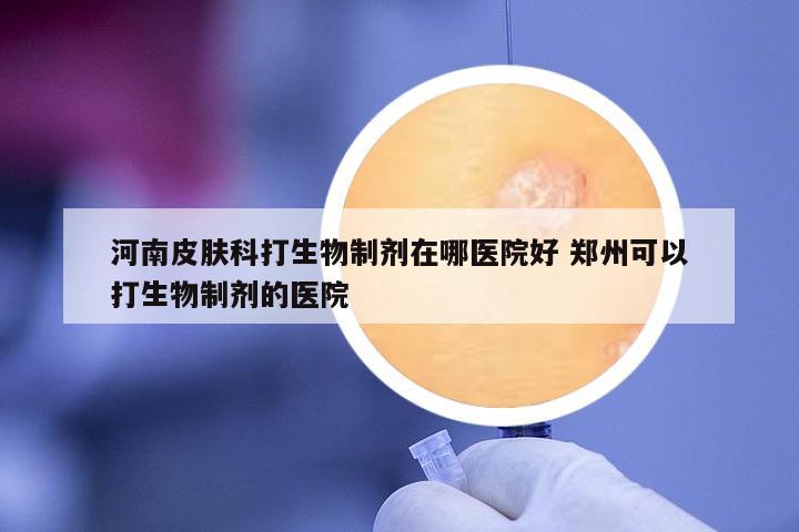 河南皮膚科打生物制劑在哪醫(yī)院好 鄭州可以打生物制劑的醫(yī)院