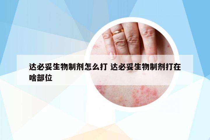 達(dá)必妥生物制劑怎么打 達(dá)必妥生物制劑打在啥部位