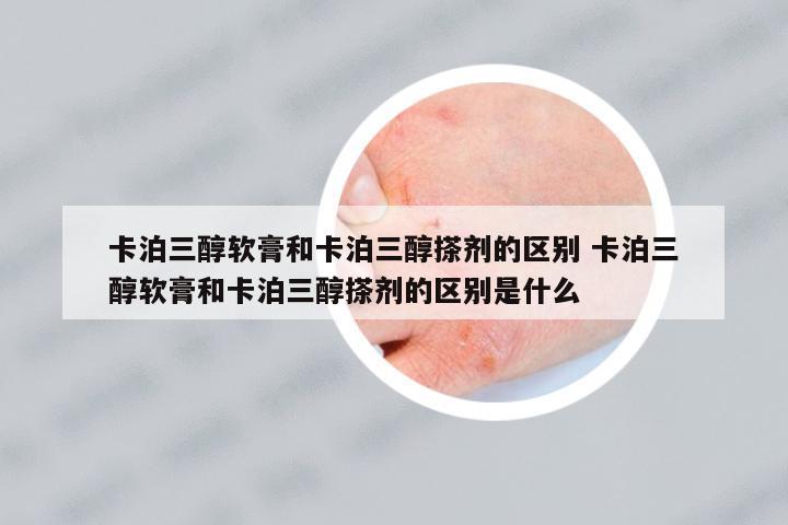 卡泊三醇軟膏和卡泊三醇搽劑的區(qū)別 卡泊三醇軟膏和卡泊三醇搽劑的區(qū)別是什么