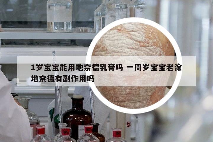 1歲寶寶能用地奈德乳膏嗎 一周歲寶寶老涂地奈德有副作用嗎