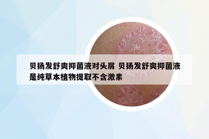 貝揚(yáng)發(fā)舒爽抑菌液對頭屑 貝揚(yáng)發(fā)舒爽抑菌液是純草本植物提取不含激素