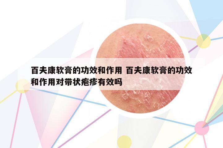 百夫康軟膏的功效和作用 百夫康軟膏的功效和作用對(duì)帶狀皰疹有效嗎