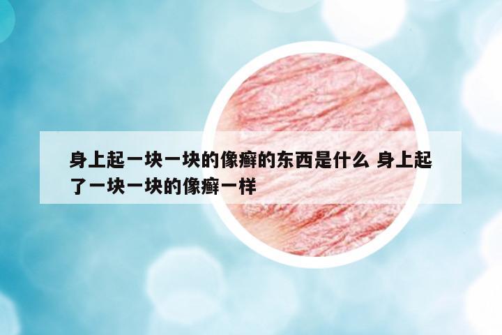 身上起一塊一塊的像癬的東西是什么 身上起了一塊一塊的像癬一樣