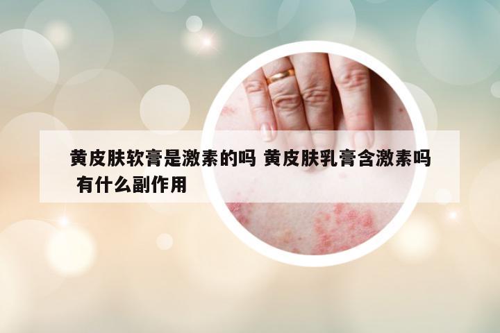 黃皮膚軟膏是激素的嗎 黃皮膚乳膏含激素嗎 有什么副作用