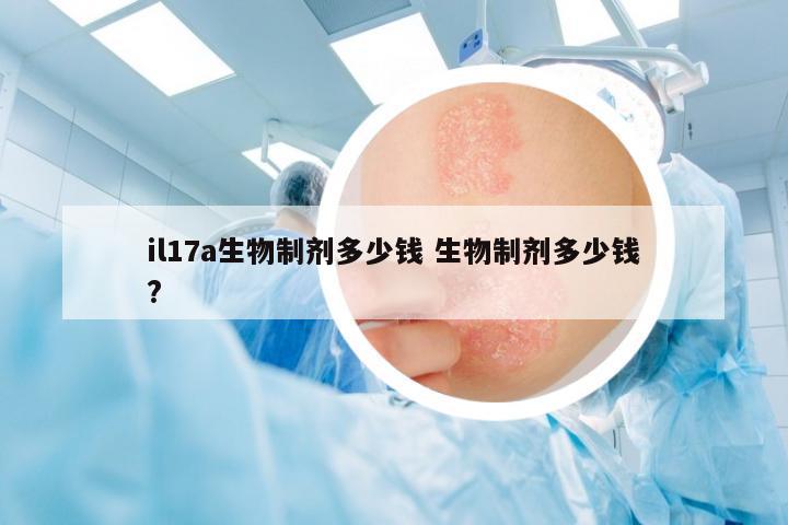 il17a生物制劑多少錢 生物制劑多少錢?